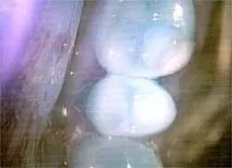 diamondbrite