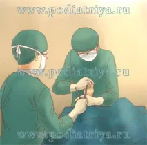стопі