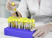 Остеопороз грудного відділу основні симптоми та методи боротьби остеопороз