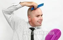 Причини та засоби NSP проти випадіння волосся, облисіння причини