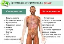 Ракова інтоксикація інтоксикація