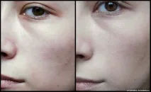 Зволожуючий Bb-Крем Guerlain Super Aqua-Serum BB Hydra Beauty Balm Instant Hydration Perfects SPF guerlain