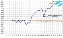 Затримка при базальній температурі 37° та негативному тесті негативному