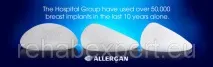 Allergan Natrelle Gel Breast Implant Анатомічні імпланти молочних залоз у Києві - ТОВ Рехаб анатомічні