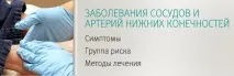 артерій