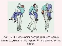 іммобілізація