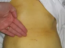Кіста печінки - фото,опис, коментарі до фото печінки