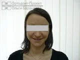 адентії