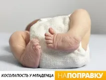 Ксолопатість у дітей причини, лікування вродженої клишоногості, брейси лікування
