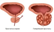 простатата