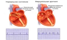 предсърдно