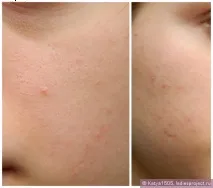 Мінеральна компактна пудра Mineral Wear Correcting Powder (відтінок Natural Beige) від Physician - компактна