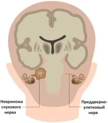 симптоми