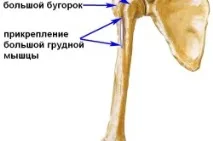Перелом великого горбка плечової кістки плечової