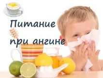 Харчування при ангіні ангіні
