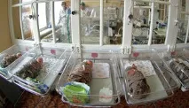 Чому ми бачимо обличчя на Марсі та на бутербродах марсі