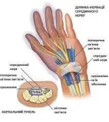 карпалния