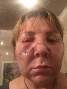 З криком Здохни, сука - сусід спробував розрубати - яблучницю - у Всеволожську - Статті - сусід