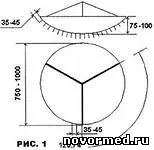 йонизация