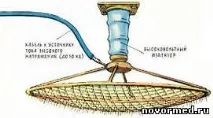 аероиони