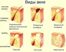 бананова