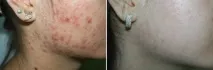 шкірка