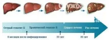 Хронічний гепатит та армія, Служба допомоги Призовникам - Здоров’я Інфо призовникам