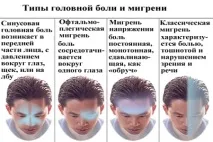Дієта при мігрені Лікувальне харчування від мігрені, меню, рецепти мігрені