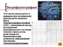 ЕЕГ головного мозку, що таке і що показує мозку
