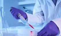 Генітальний герпес збудник інфекції герпес
