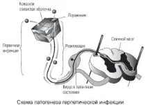 Генітальний герпес збудник інфекції інфекції