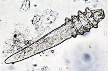 Demodex