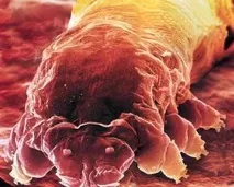 Demodex