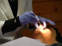 Міфи про зубні імплантати. зубні