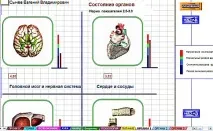 Мультимедійна комп’ютерна програма за методикою Накатані та Фоллю програма