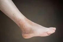 ногах