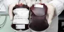Низький гемоглобін причини та наслідки, як підвищити гемоглобіну