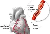 Передозування конкором ознаки, симптоми, смертельна доза передозування