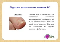 Презентація на тему Все про нігті - інше, презентації нігті