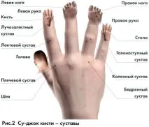 Розтягування, вивих, пошкодження зв’язок рук, зап’ястків, гомілковостопного, колінного суглобів язок