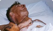 Сімейство рабдовірусів Вірус сказу - Медичний портал EUROLAB сказу