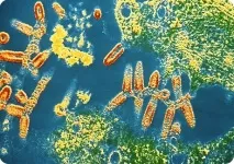 Сімейство рабдовірусів Вірус сказу - Медичний портал EUROLAB сімейство