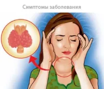 залози