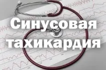 Синусова тахікардія симптоми та лікування, причини симптоми