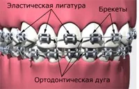 Стоматологія Олександрія, Сисерть - 50 км олександрія