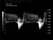 УЗД апарат UltraSonix Sonix Touch sonix
