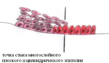 гінекологічні