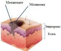 повредената