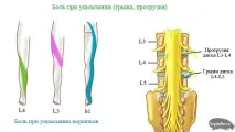 грижа