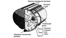 ускладнення